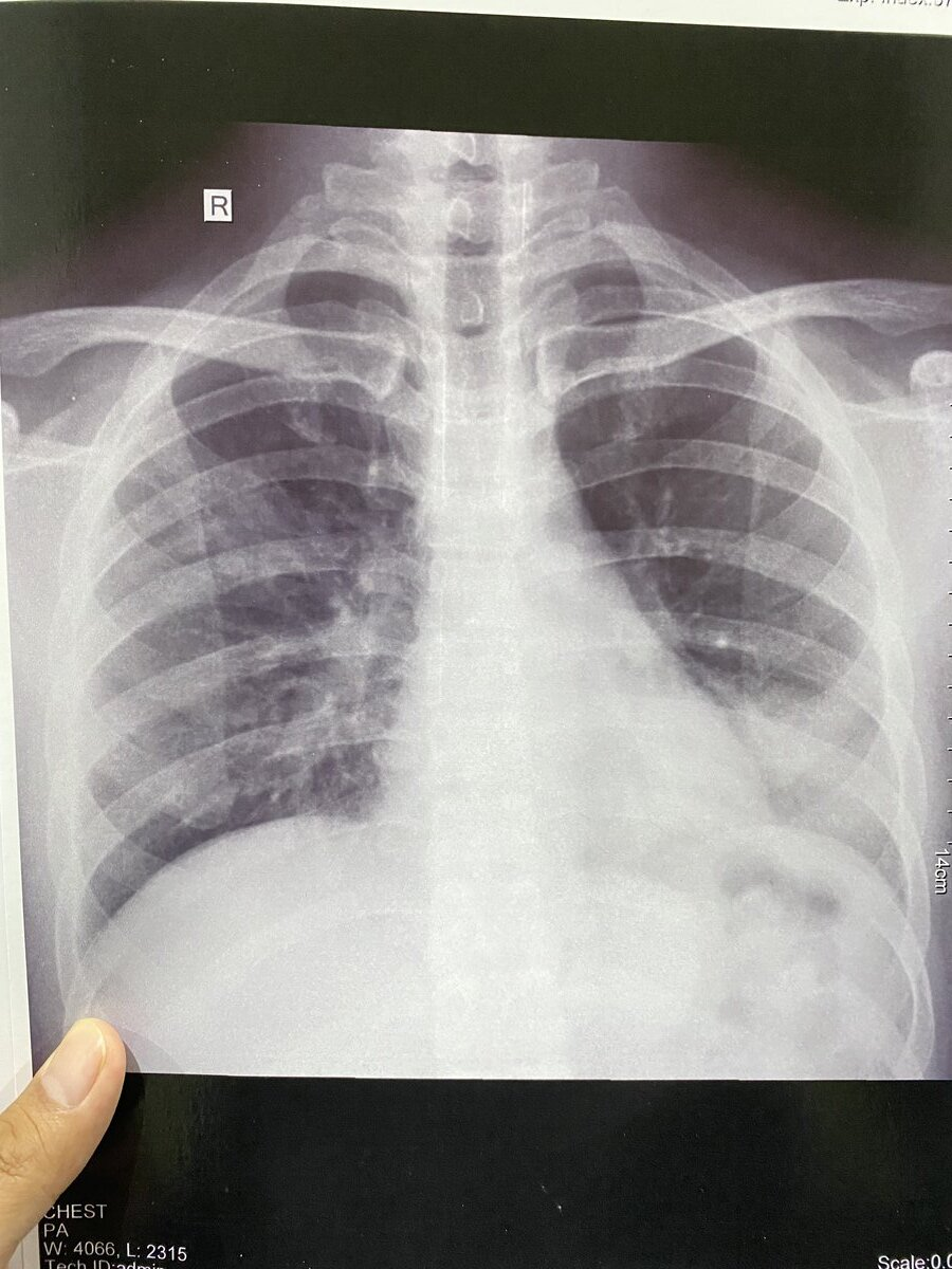 Tumbang juga akhirnya